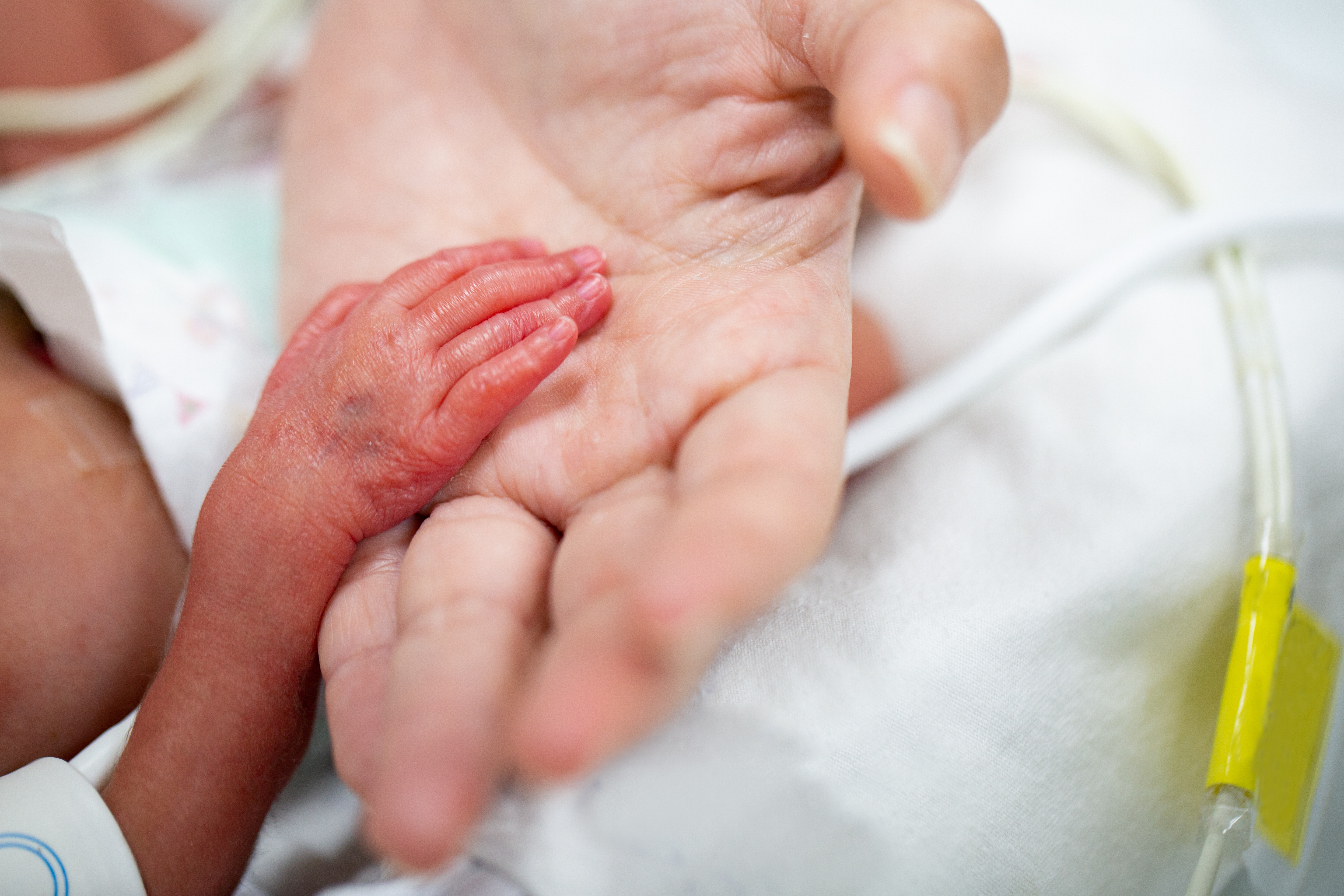 Hand eines Frühchens in der Hand seiner Mutter